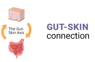 The Gut-Skin Connection: How Your Diet Affects Your Complexion