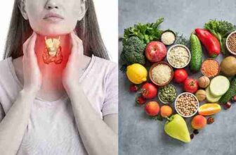 Thyroid-Smart Eating: Everyday Foods People With Thyroid Issues Should Limit