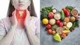 Thyroid-Smart Eating: Everyday Foods People With Thyroid Issues Should Limit